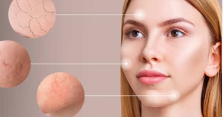 Bí Quyết Làm Dịu Và Phục Hồi Làn Da
